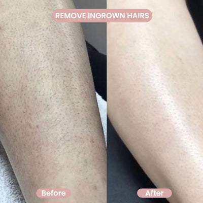 GlowShave™ | 2-in-1 Body Shaver